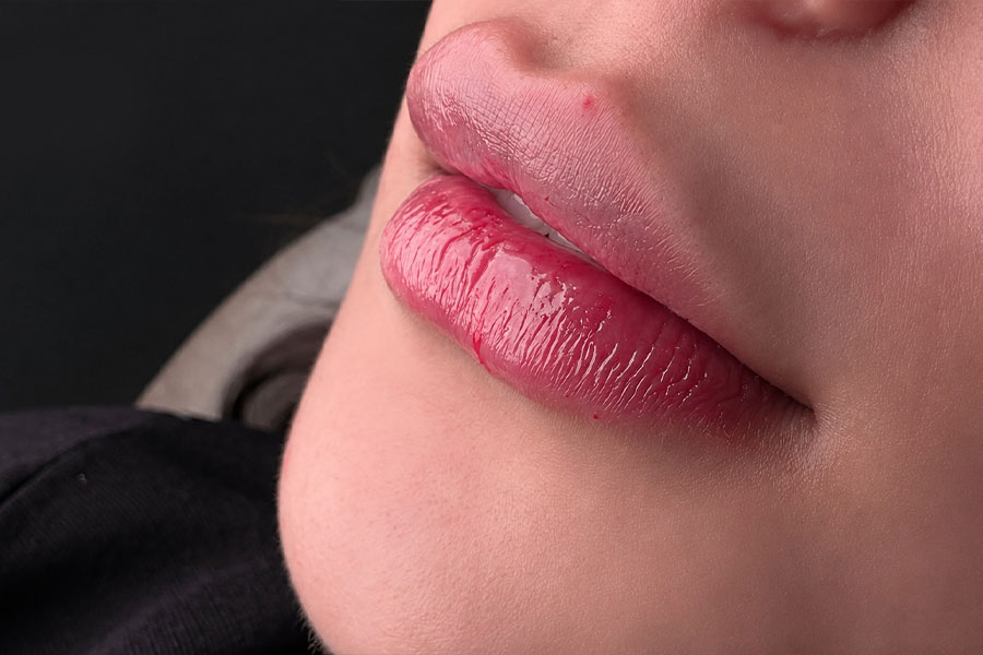 نتیجه پس از خدمات کلینیک